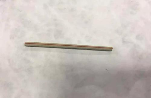 伊通14岁女孩将6厘米长棒棒糖吞进肚……