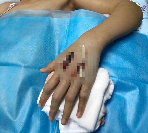 网购毒蛇？双阳13岁男孩这回玩大了……