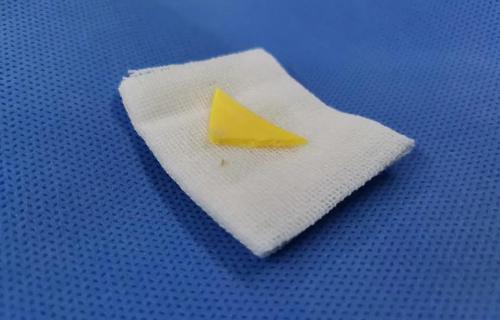 “溶豆”作怪？异物取出时，医生惊讶了