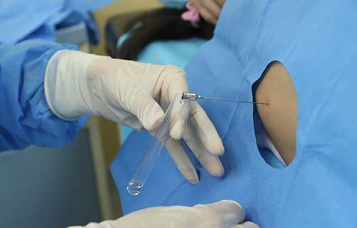 啪啪网
首例SMA治疗见成效