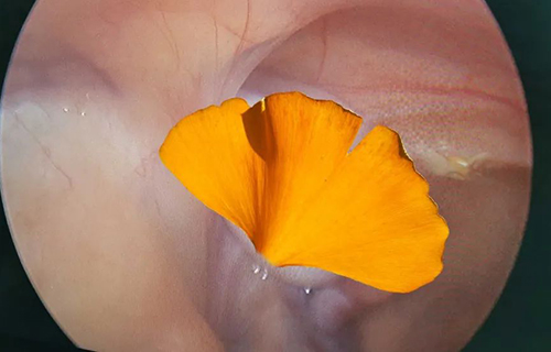 失踪14个月的“蛋蛋”找到了