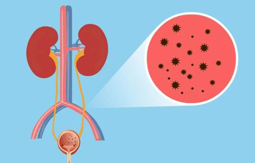 名医专栏丨小儿泌尿系统常见疾病的防治