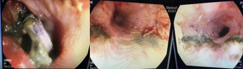 孩子误食物品千万别无视